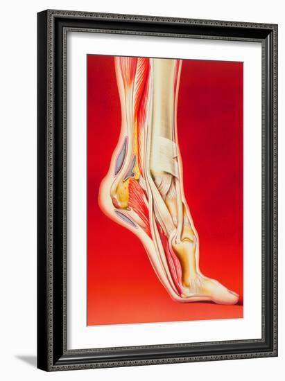 Artwork Showing Calcaneal Spur And Foot Pain-John Bavosi-Framed Photographic Print