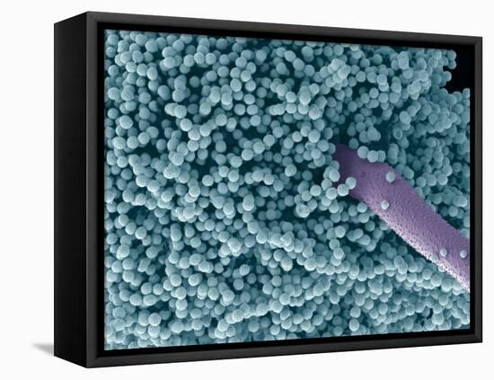 Aspergillus Fungus Spores, SEM-Steve Gschmeissner-Framed Premier Image Canvas