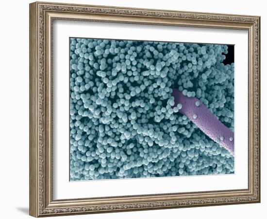 Aspergillus Fungus Spores, SEM-Steve Gschmeissner-Framed Photographic Print