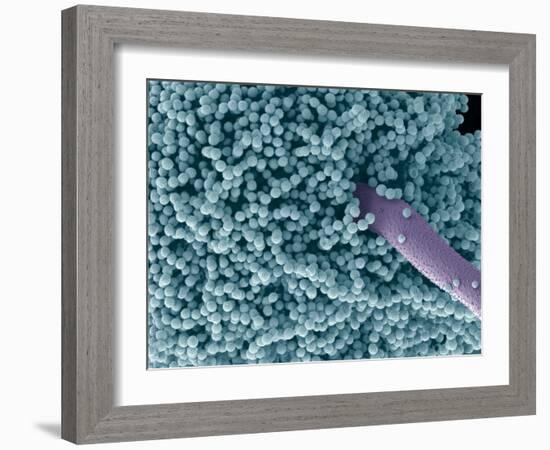 Aspergillus Fungus Spores, SEM-Steve Gschmeissner-Framed Photographic Print