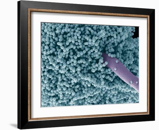 Aspergillus Fungus Spores, SEM-Steve Gschmeissner-Framed Photographic Print