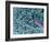 Aspergillus Fungus Spores, SEM-Steve Gschmeissner-Framed Photographic Print