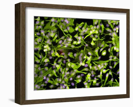 Astrocyte Brain Cells, Light Micrograph-Riccardo Cassiani-ingoni-Framed Photographic Print