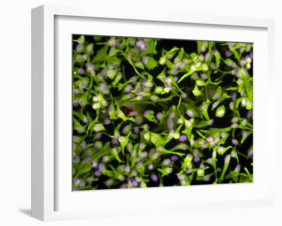 Astrocyte Brain Cells, Light Micrograph-Riccardo Cassiani-ingoni-Framed Photographic Print