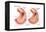 Atherosclerosis-Encyclopaedia Britannica-Framed Stretched Canvas