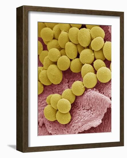 Athlete's Foot Fungus, SEM-Steve Gschmeissner-Framed Photographic Print