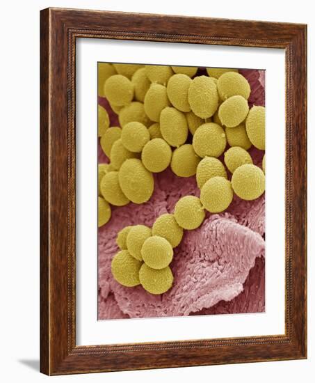 Athlete's Foot Fungus, SEM-Steve Gschmeissner-Framed Photographic Print