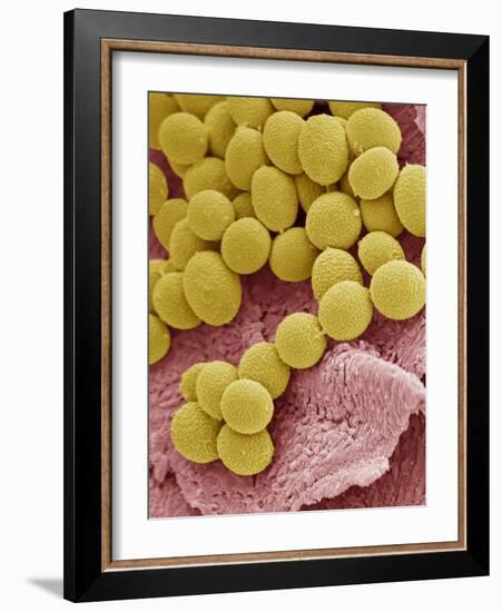 Athlete's Foot Fungus, SEM-Steve Gschmeissner-Framed Photographic Print