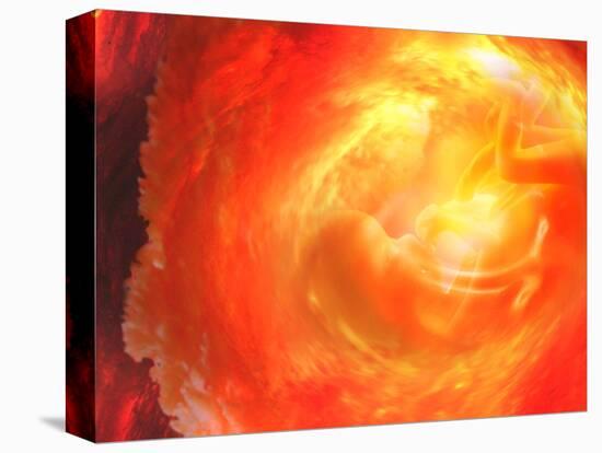 Stretched Canvas Print, , large