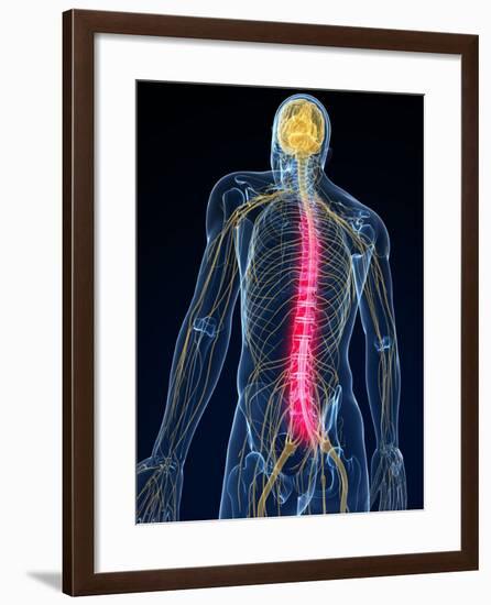 Back Pain, Conceptual Artwork-SCIEPRO-Framed Photographic Print