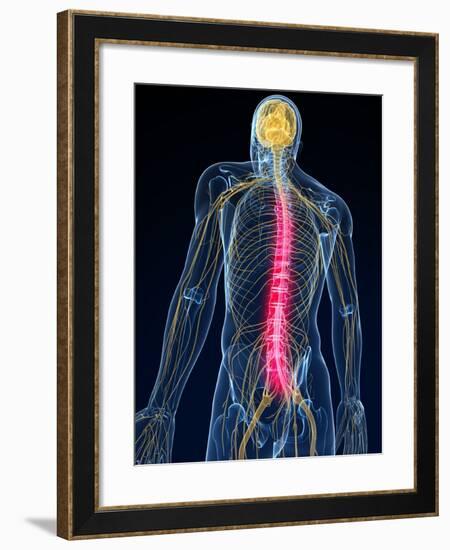 Back Pain, Conceptual Artwork-SCIEPRO-Framed Photographic Print