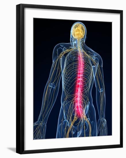 Back Pain, Conceptual Artwork-SCIEPRO-Framed Photographic Print