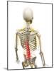Back Pain, Conceptual Artwork-SCIEPRO-Mounted Photographic Print