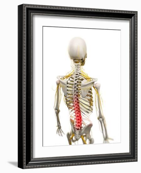 Back Pain, Conceptual Artwork-SCIEPRO-Framed Photographic Print