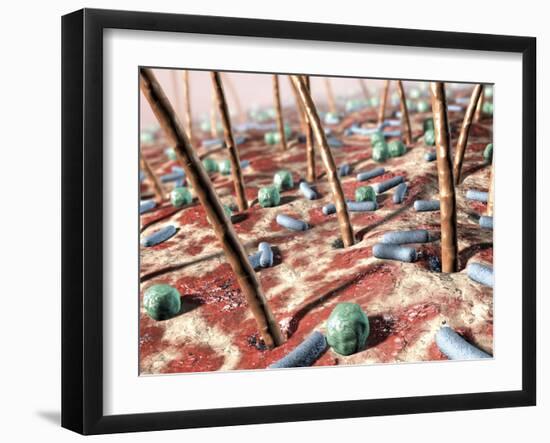 Bacteria on Skin-David Mack-Framed Photographic Print