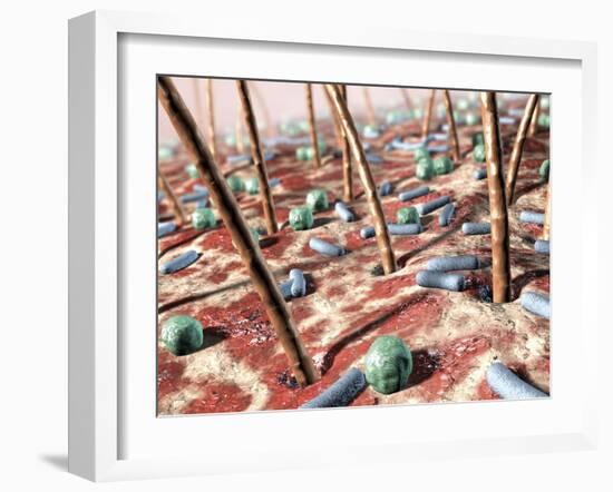 Bacteria on Skin-David Mack-Framed Photographic Print