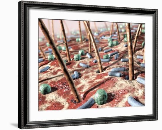 Bacteria on Skin-David Mack-Framed Photographic Print