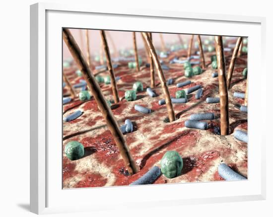 Bacteria on Skin-David Mack-Framed Photographic Print
