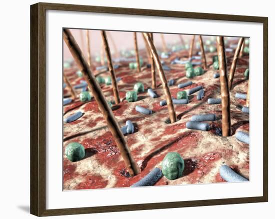 Bacteria on Skin-David Mack-Framed Photographic Print