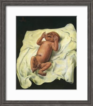 Bebe Avec Cordon Ombilical C 1927 Art Print Otto Dix Art Com