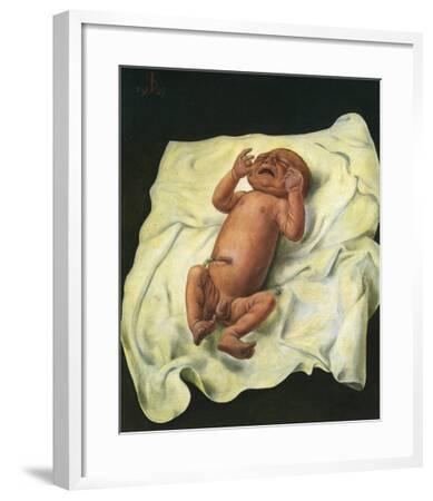 Bebe Avec Cordon Ombilical C 1927 Art Print Otto Dix Art Com