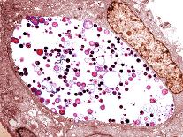 Helicobacter Pylori Bacterium, TEM-Biomedical Imaging-Framed Photographic Print