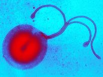 Clostridium Difficile Bacteria, TEM-Biomedical Imaging-Photographic Print