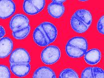 MRSA Bacteria, TEM-Biomedical Imaging-Framed Photographic Print