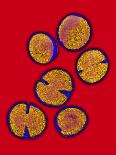 MRSA Bacteria-Biomedical Imaging-Framed Photographic Print