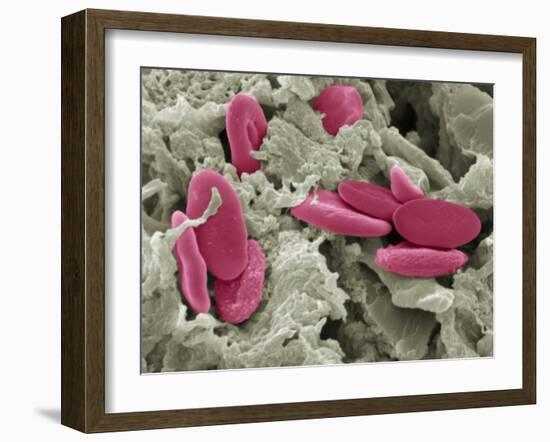 Bird Red Blood Cells, SEM-Steve Gschmeissner-Framed Photographic Print