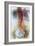 Blocked Artery, X-ray-null-Framed Photographic Print