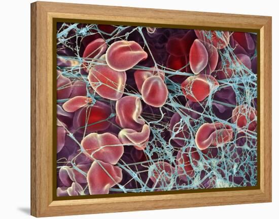 Blood Clot, SEM-Steve Gschmeissner-Framed Premier Image Canvas