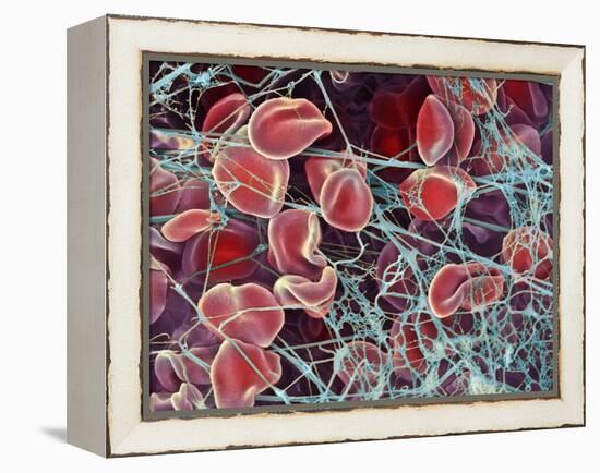 Blood Clot, SEM-Steve Gschmeissner-Framed Premier Image Canvas