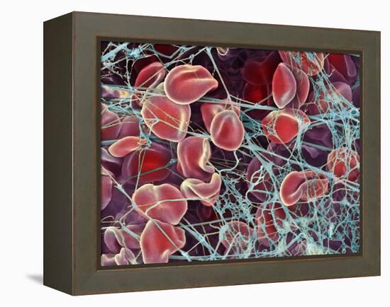 Blood Clot, SEM-Steve Gschmeissner-Framed Premier Image Canvas