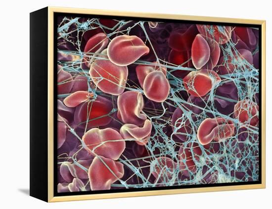 Blood Clot, SEM-Steve Gschmeissner-Framed Premier Image Canvas