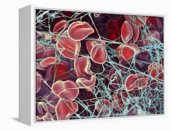 Blood Clot, SEM-Steve Gschmeissner-Framed Premier Image Canvas