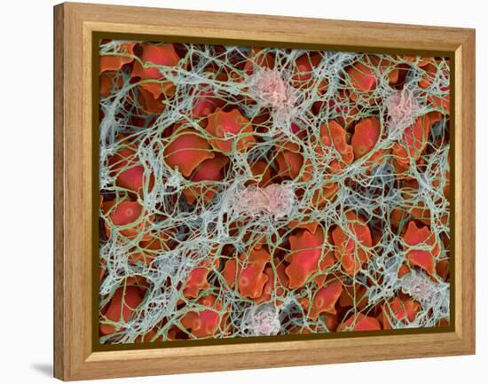 Blood Clot, SEM-Steve Gschmeissner-Framed Premier Image Canvas