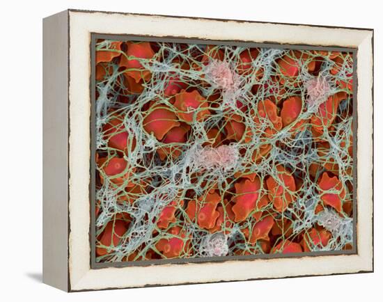 Blood Clot, SEM-Steve Gschmeissner-Framed Premier Image Canvas