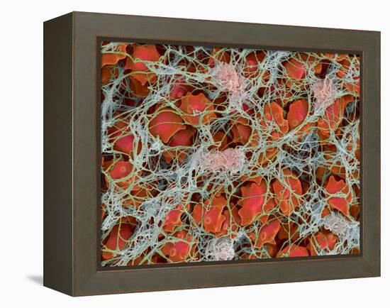 Blood Clot, SEM-Steve Gschmeissner-Framed Premier Image Canvas