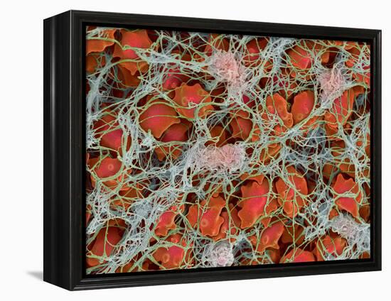 Blood Clot, SEM-Steve Gschmeissner-Framed Premier Image Canvas