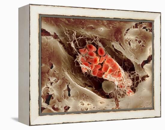 Blood Clot, SEM-Science Photo Library-Framed Premier Image Canvas