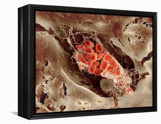 Blood Clot, SEM-Science Photo Library-Framed Premier Image Canvas