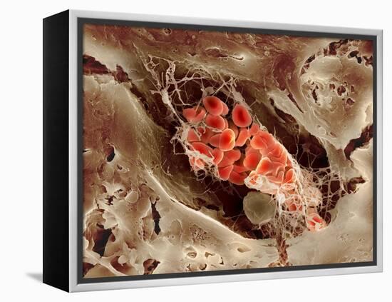 Blood Clot, SEM-Science Photo Library-Framed Premier Image Canvas