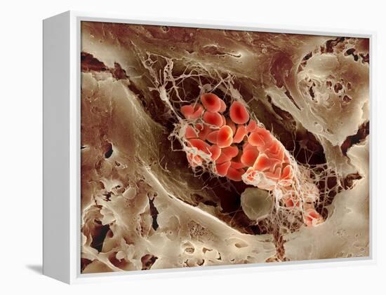 Blood Clot, SEM-Science Photo Library-Framed Premier Image Canvas