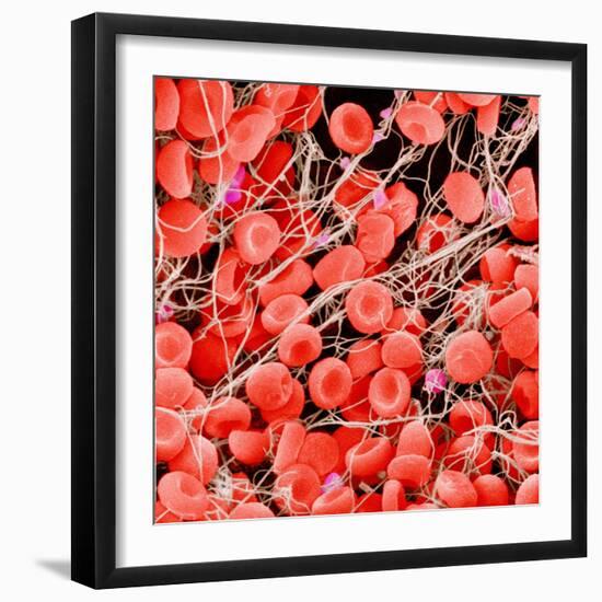 Blood Clot, SEM-Susumu Nishinaga-Framed Premium Photographic Print