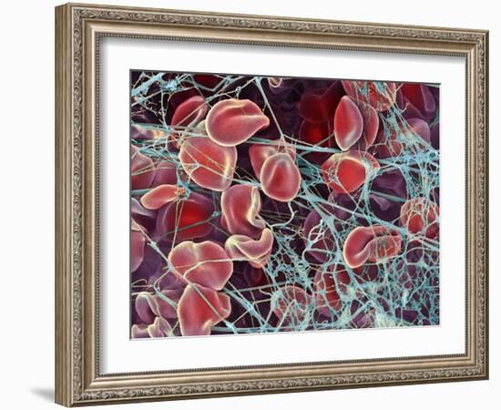 Blood Clot, SEM-Steve Gschmeissner-Framed Photographic Print