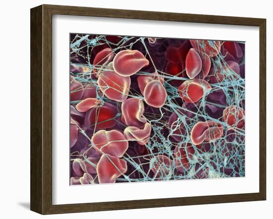 Blood Clot, SEM-Steve Gschmeissner-Framed Photographic Print