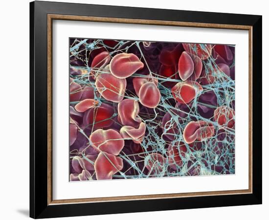 Blood Clot, SEM-Steve Gschmeissner-Framed Photographic Print