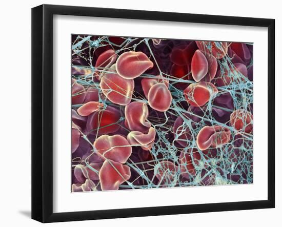 Blood Clot, SEM-Steve Gschmeissner-Framed Photographic Print