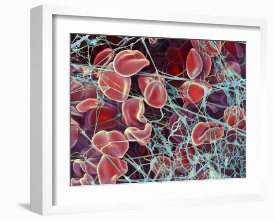 Blood Clot, SEM-Steve Gschmeissner-Framed Photographic Print